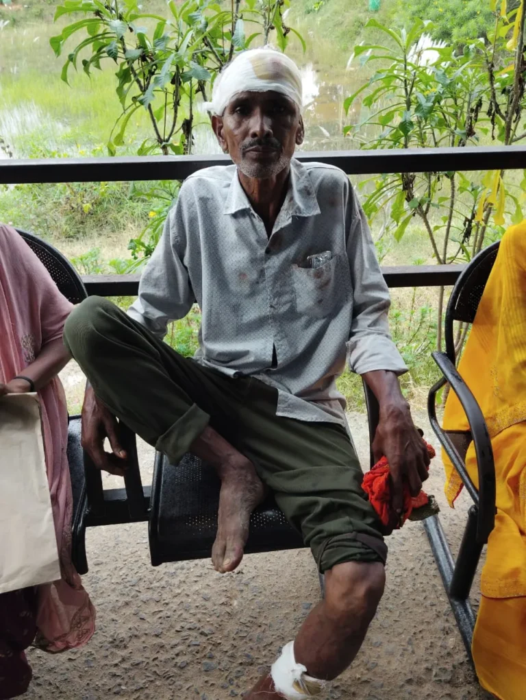 CHANDAN NEWS: जमीन विवाद को लेकर दो पक्षों में मारपीट, कई लोग जख्मी, मामला पहुंचा चांदन थाना