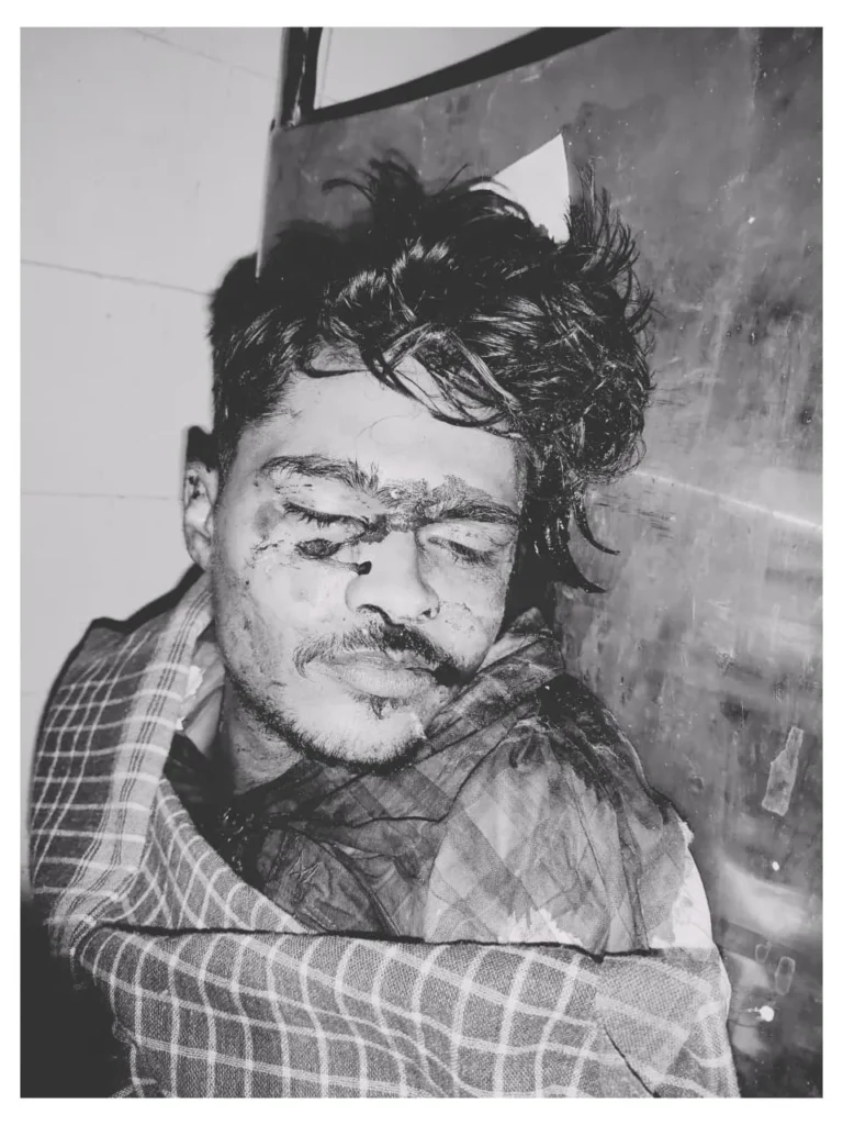 CHANDAN NEWS: मेला देखने गए युवक को मारी गोली, हुआ मौत जांच में जुटी पुलिस